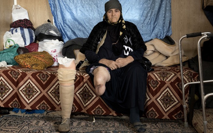 Moheileh sitzt auf einem Bett. Sie zeigt ihren Stumpf und neben ihr steht die Prothese