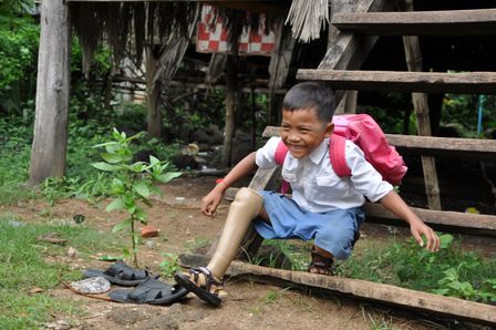 Dank der Prothese von HI kann Chetra aus Kambodscha zur Schule gehen.
