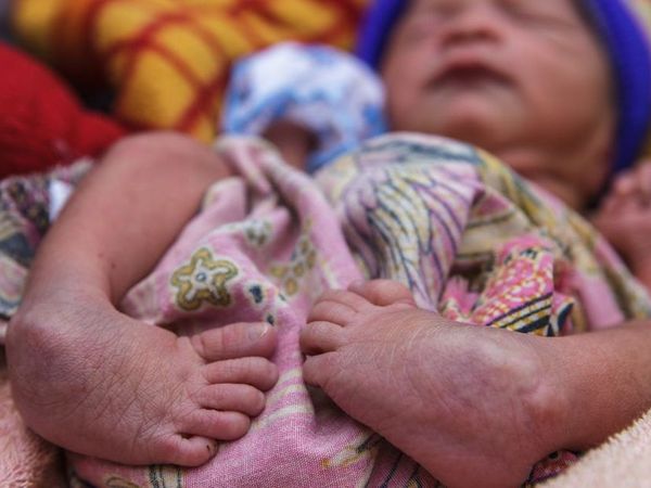 Ein neu geborenes Baby mit Klumpfüßen