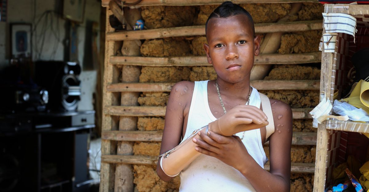 Jemerson aus Kolumbien hält seine Armprothese in die Kamera. Er verlor seinen linken Arm durch eine Mine.