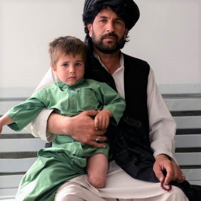 Sayed (6) aus Afghanistan verlor sein Bein durch einen improvisierten Sprengsatz. Ohne die Amputation des verletzten Beines hätte er nicht überlebt.