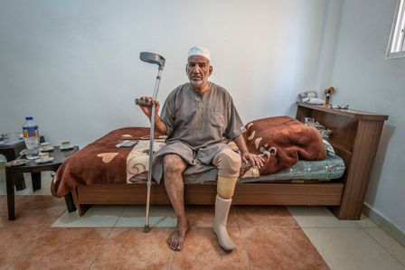 Aufgrund einer Infektion musste Abdelkrims linkes Bein teils amputiert werden