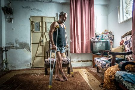Ibrahims Bein wurde bei einem Bombenanschlag verletzt